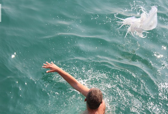 How to treat a jellyfish sting